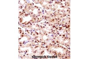 Immunohistochemistry (IHC) image for anti-Thymopoietin (TMPO) antibody (ABIN2998199) (Thymopoietin 抗体)