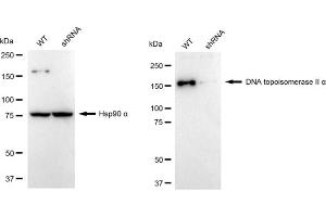 Western blotting analysis using DNA topoisomerase II alpha antibody (ABIN7800574).