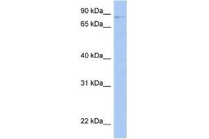 WB Suggested Anti-LRRC33 Antibody Titration: 0. (LRRC33 抗体  (Middle Region))