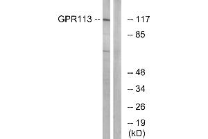 Western blot analysis of extracts from LOVO cells, using GPR113 antibody.