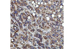 IHC analysis of RRS1 using anti-RRS1 antibody (ABIN7602918). (RRS1 抗体  (C-Term))