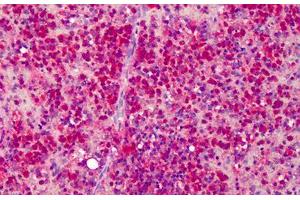 Human Spleen: Formalin-Fixed, Paraffin-Embedded (FFPE) (beta Actin 抗体  (C-Term))
