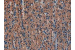 IHC-P analysis of Rat Stomach Tissue, with DAB staining. (Lactate Dehydrogenase A 抗体  (AA 1-332))
