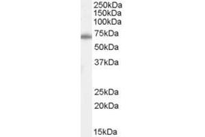 Western Blotting (WB) image for anti-Chymotrypsin-Like Elastase Family, Member 2A (CELA2A) (C-Term) antibody (ABIN2787346)