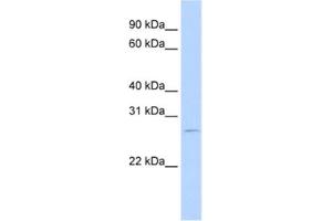 Western Blotting (WB) image for anti-RNA Binding Motif Protein 38 (RBM38) antibody (ABIN2462271) (RBM38 抗体)