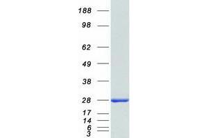 Western Blotting (WB) image for Cyclin-Dependent Kinase Inhibitor 2D (p19, Inhibits CDK4) (CDKN2D) (Transcript Variant 1) protein (Myc-DYKDDDDK Tag) (ABIN2713883)