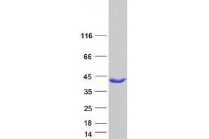 Western Blotting (WB) image for UDP-Galactose-4-Epimerase (GALE) (Transcript Variant 3) protein (Myc-DYKDDDDK Tag) (ABIN2721598)
