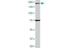 A2M MaxPab rabbit polyclonal antibody. (alpha 2 Macroglobulin 抗体  (AA 1-1474))