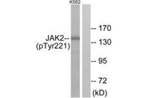 Western blot analysis of extracts from K562 cells, using JAK2 (Phospho-Tyr221) Antibody. (JAK2 抗体  (pTyr221))