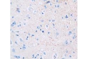 Used in DAB staining on fromalin fixed paraffin- embedded Kidney tissue (GDF10 抗体  (AA 1-288))