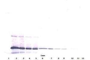 Image no. 4 for anti-Interleukin 11 (IL11) antibody (ABIN465144) (IL-11 抗体)