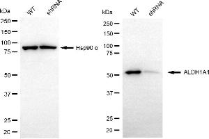 Western blotting analysis using ALDH1A1 antibody (ABIN7797555). (ALDH1A1 抗体)