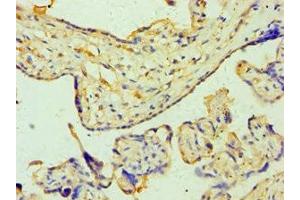 Immunohistochemistry (IHC) image for anti-Zinc Finger Protein 346 (ZNF346) (AA 1-294) antibody (ABIN7176252)