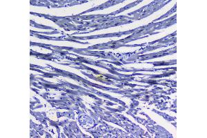 IHC analysis of MAX using anti-MAX antibody . (MAX 抗体  (AA 30-106))