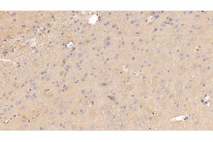 Immunohistochemistry (IHC) image for anti-Apolipoprotein E (APOE) (AA 19-168) antibody (ABIN7427423)