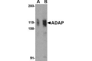 Western Blotting (WB) image for anti-FYN-Binding Protein (FYB) (N-Term) antibody (ABIN1031214)