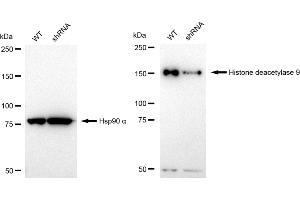 Western blotting analysis using Histone deacetylase 9 antibody (ABIN7798938). (Recombinant HDAC9 抗体)