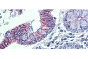 Immunohistochemistry with Human Colon lysate tissue at an antibody concentration of 5. (Desmoglein 2 抗体  (N-Term))