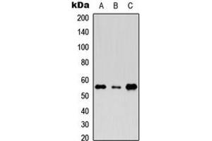 Western blot analysis of Rhotekin expression in HeLa (A), Raw264. (Rhotekin 抗体  (Center))