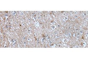 Immunohistochemistry of paraffin-embedded Human brain tissue using BMP1 Polyclonal Antibody at dilution of 1:105(x200) (BMP1 抗体)