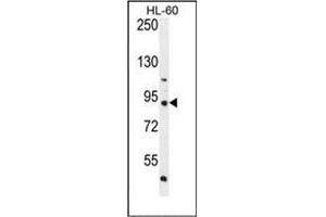 Western blot analysis of KIAA1586 Antibody (N-term) Cat. (KIAA1586 抗体  (N-Term))