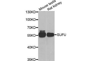 Western blot analysis of extracts of various cell lines, using SUFU antibody (ABIN5974087) at 1/1000 dilution. (SUFUH 抗体)
