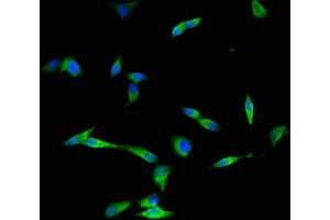 Immunofluorescence (IF) image for anti-Dynein, Cytoplasmic 2, Heavy Chain 1 (DYNC2H1) (AA 1928-2065) antibody (ABIN7149322)