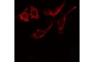 ABIN6274866 staining Hela cells by IF/ICC. (Arylsulfatase E 抗体  (Internal Region))