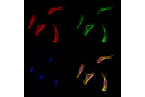 ABIN6261469 and ABIN6278061 staining Hela cells by IF/ICC. (EHD1 抗体  (C-Term))