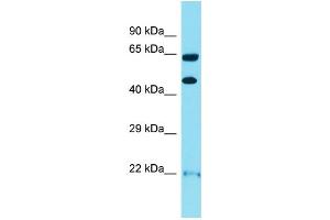 WB Suggested Anti-OPRK1 Antibody Titration:  1 ug/ml  Positive Control:  HuFetal Kidney (OPRK1 抗体  (N-Term))