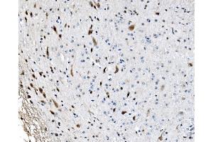 IHC analysis of GRX2/GLRX2 using anti-GRX2/GLRX2 antibody (ABIN7599022).