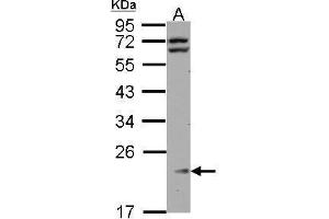 WB Image Sample (30 ug of whole cell lysate) A: HeLa 12% SDS PAGE antibody diluted at 1:1000 (RPL11 抗体)