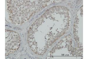 Immunoperoxidase of monoclonal antibody to MAP3K4 on formalin-fixed paraffin-embedded human testis. (MAP3K4 抗体  (AA 1201-1300))