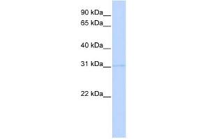 WB Suggested Anti-PRMT6 Antibody Titration:  0. (PRMT6 抗体  (Middle Region))
