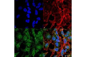 Immunocytochemistry/Immunofluorescence analysis using Rabbit Anti-UVRAG Polyclonal Antibody . (UVRAG 抗体  (PE))