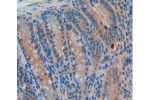 Used in DAB staining on fromalin fixed paraffin- embedded intestine tissue (CDKN2B 抗体  (AA 1-130))
