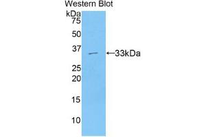 Western blot analysis of the recombinant protein. (AXIN2 抗体  (AA 350-631))