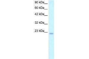 Human Daudi; WB Suggested Anti-POLE3 Antibody Titration: 2. (POLE3 抗体  (N-Term))