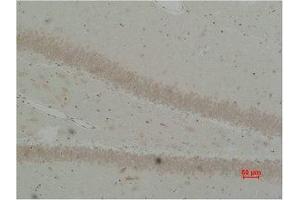 Immunohistochemical analysis of paraffin-embedded Rat Brain Tissue using BEST2 Polyclonal Antibody. (Bestrophin 2 抗体)