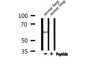 Western blot analysis of extracts from mouse lung , using Keratin 9 Antibody. (KRT9 抗体  (Internal Region))