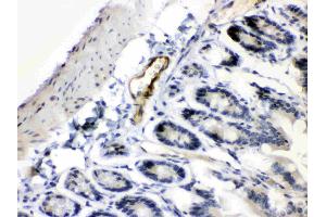 Immunohistochemistry (IHC) image for anti-Angiopoietin-Like 2 (ANGPTL2) (AA 275-312), (Middle Region) antibody (ABIN5518733)