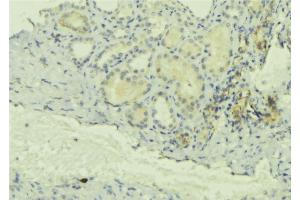 ABIN6277709 at 1/100 staining Mouse kidney tissue by IHC-P. (Chloride Channel 5 抗体  (Internal Region))