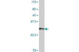 Western Blot detection against Immunogen (36. (IL3RA 抗体  (AA 19-109))