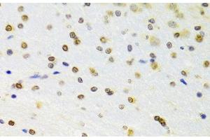 Immunohistochemistry of paraffin-embedded Rat brain using DOK1 Polyclonal Antibody at dilution of 1:100 (40x lens). (DOK1 抗体)