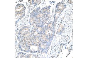 Immunohistochemistry (IHC) image for anti-Notch 1 (NOTCH1) (AA 2505-2555) antibody (ABIN7454790)