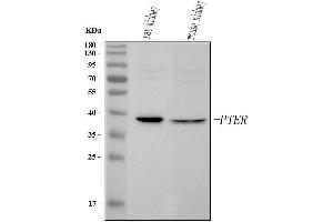 Western blot analysis of PTER using anti-PTER antibody (ABIN7599262).