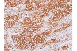 Image no. 1 for anti-Tubulin, beta 2C (TUBB2C) (Internal Region) antibody (ABIN1493535) (TUBB2C 抗体  (Internal Region))
