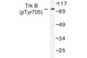 Image no. 1 for anti-Neurotrophic Tyrosine Kinase, Receptor, Type 2 (NTRK2) (pTyr705) antibody (ABIN318147) (TRKB 抗体  (pTyr705))