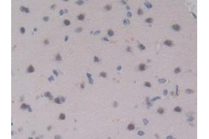 DAB staining on IHC-P; Samples: Rat Brain Tissue (IL17RA 抗体  (AA 617-847))