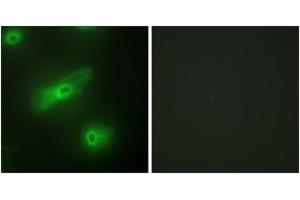 Immunofluorescence analysis of HeLa cells, using TALL-2 Antibody. (TNFSF13 抗体  (AA 151-200))